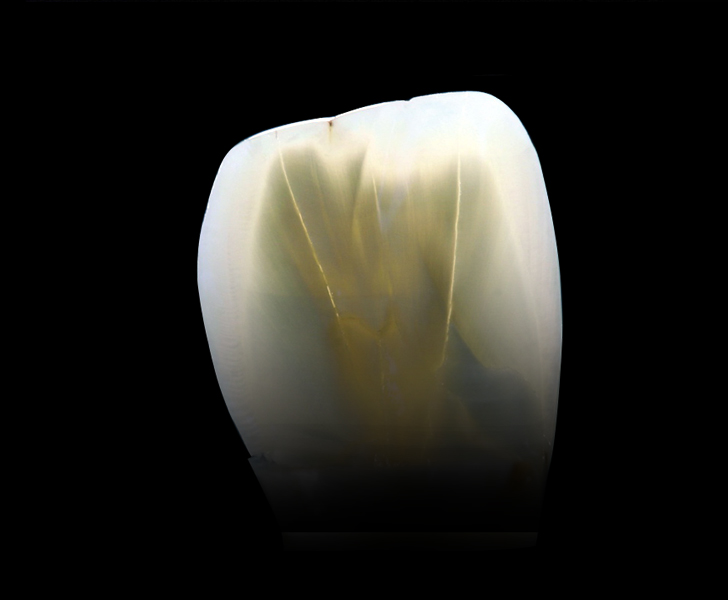 Formation GRF - GROUPE RAPHAËL FORMATION - Dentisterie esthétique